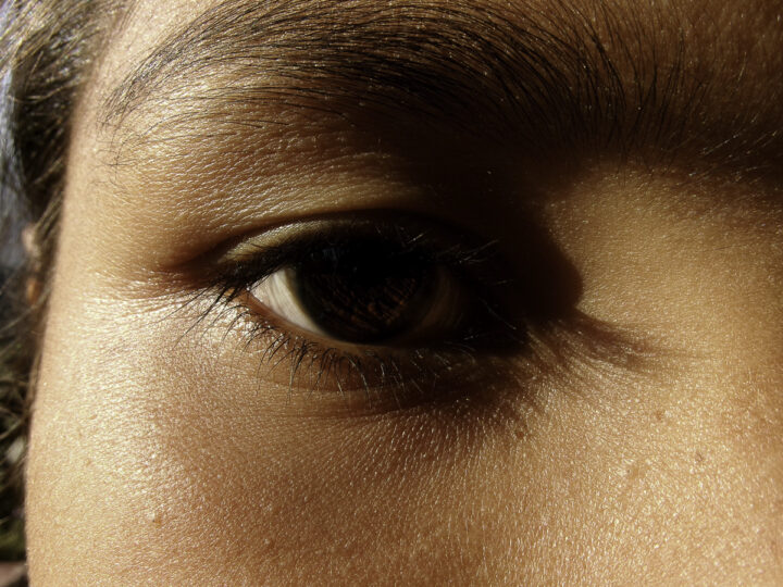 My Eye